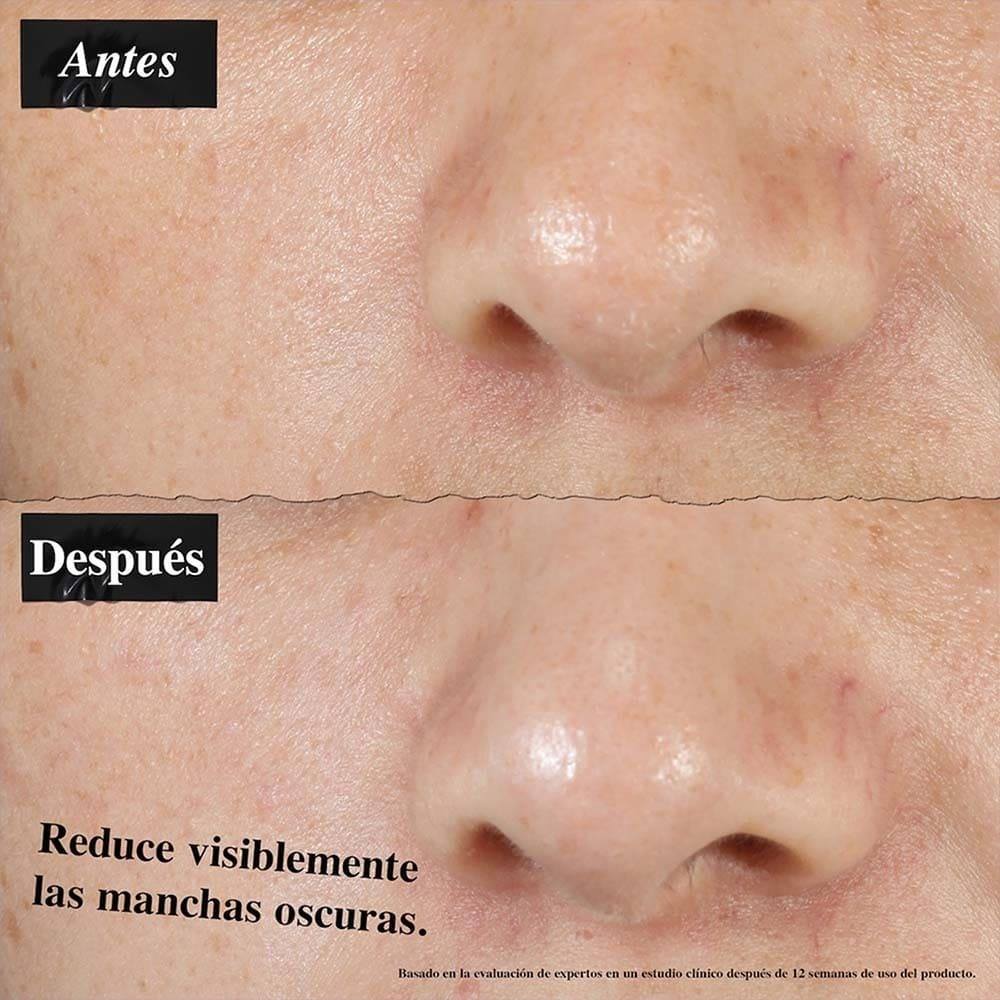 CLEARLY CORRECTIVE DARK SPOT SOLUTION ANTIMANCHAS E IMPERFECCIONES (SUERO FACIAL)